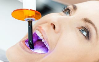 Bleaching Behandlung