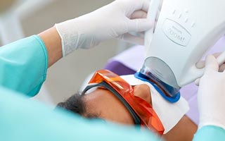 Bleaching mit Methode-Philips-Zoom!