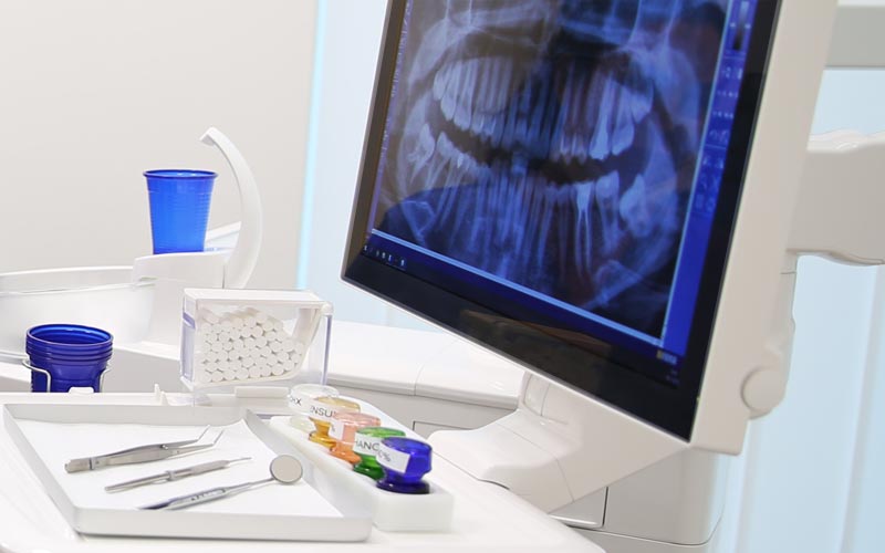 Parodontitis erkennen