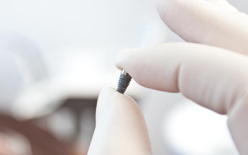 Gewindeprofil eines Zahnimplantats