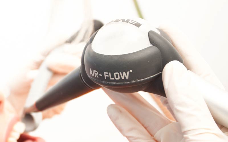 Prophylaxe mit Air-Flow