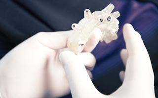 Behandlungsablauf Zahnimplantate