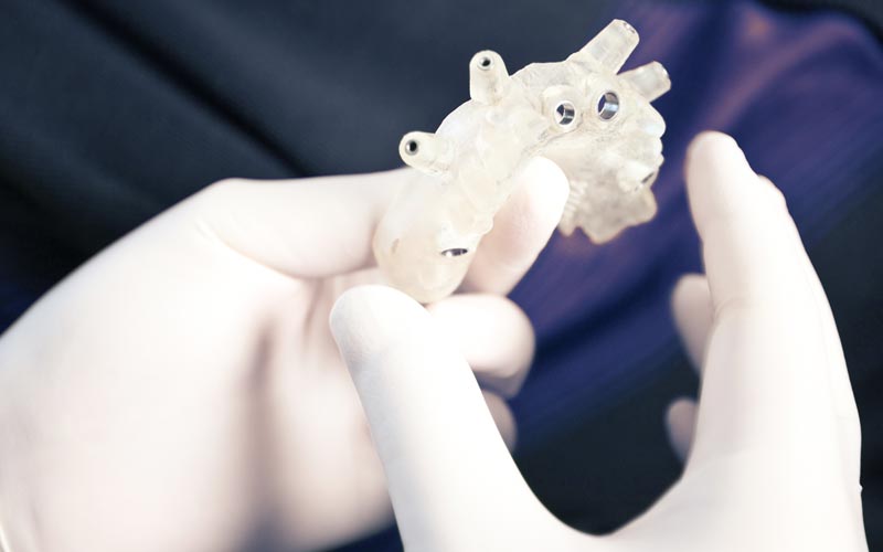 Behandlungsablauf Zahnimplantate