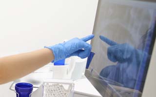 Risiken und Ursachen von Parodontitis