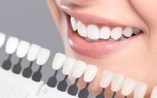 Behandlungsablauf mit Veneers in Berlin Charlottenburg