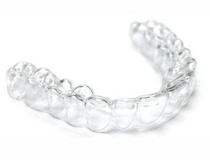 Invisalign für Kinder und Erwachsene