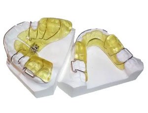 Twin Block auf einem Kiefermodell