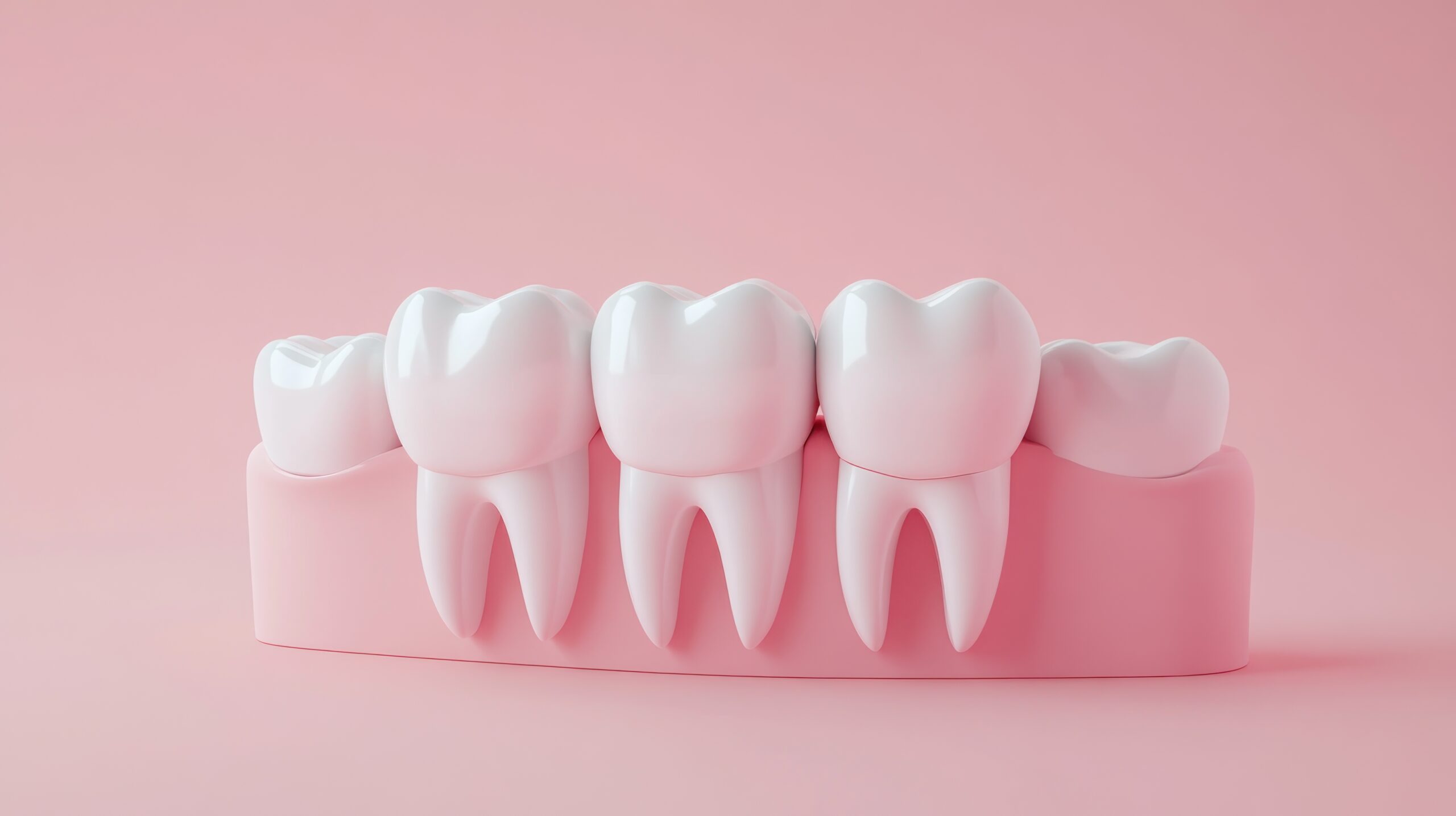 Fünf künstliche Zähne mit Wurzel