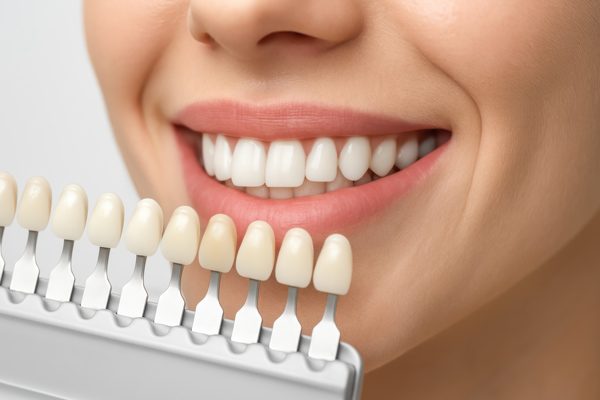 Natürlich aussehende Veneers